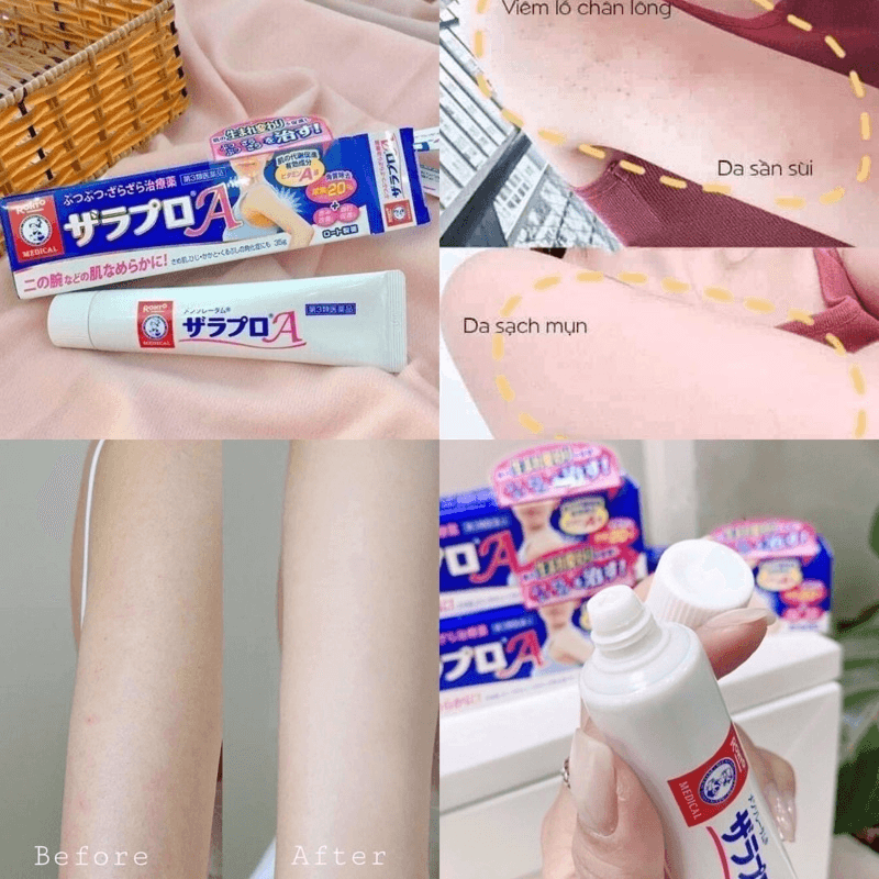 vn-11134207-7r98o-lnjwxb4cdzsq03.png
