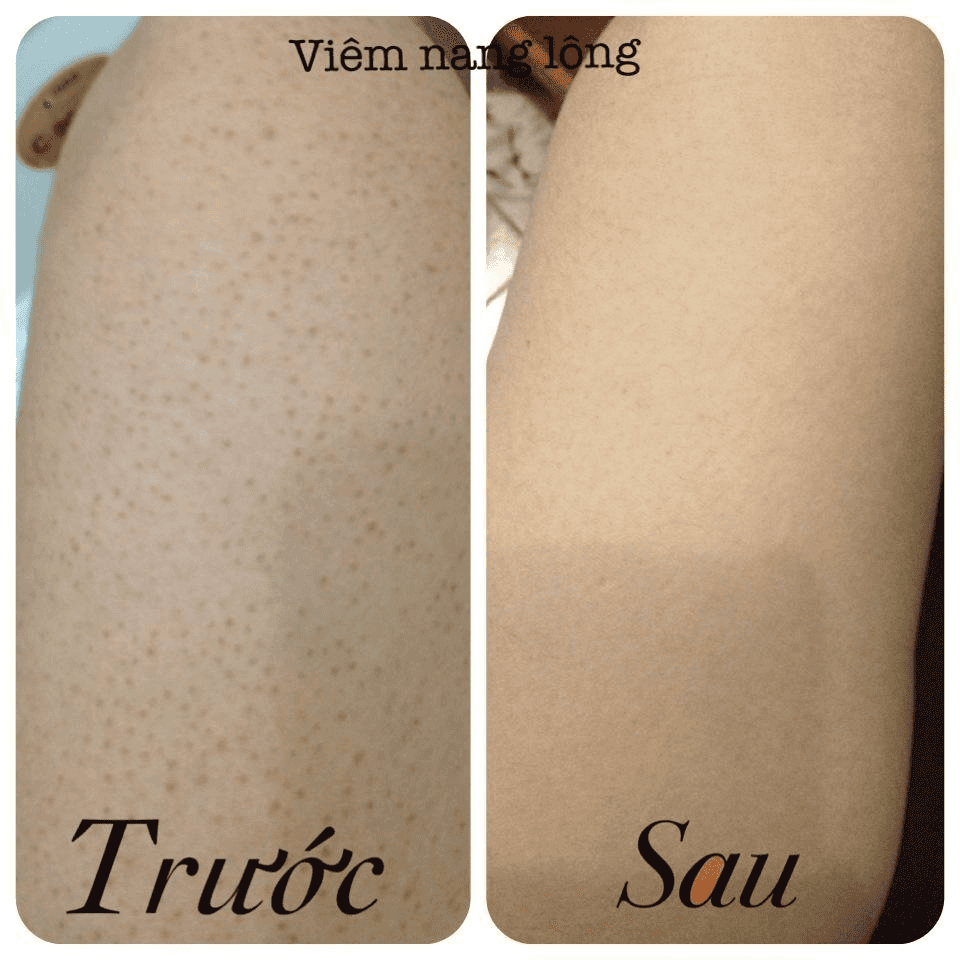 vn-11134207-7r98o-lnjwxb4wd6ka83.png